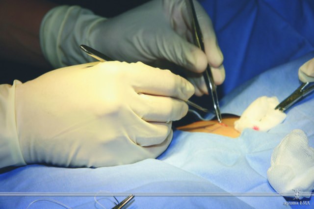 Hirurzi uspešno odstranili tumor težak 18 kilograma na VMA